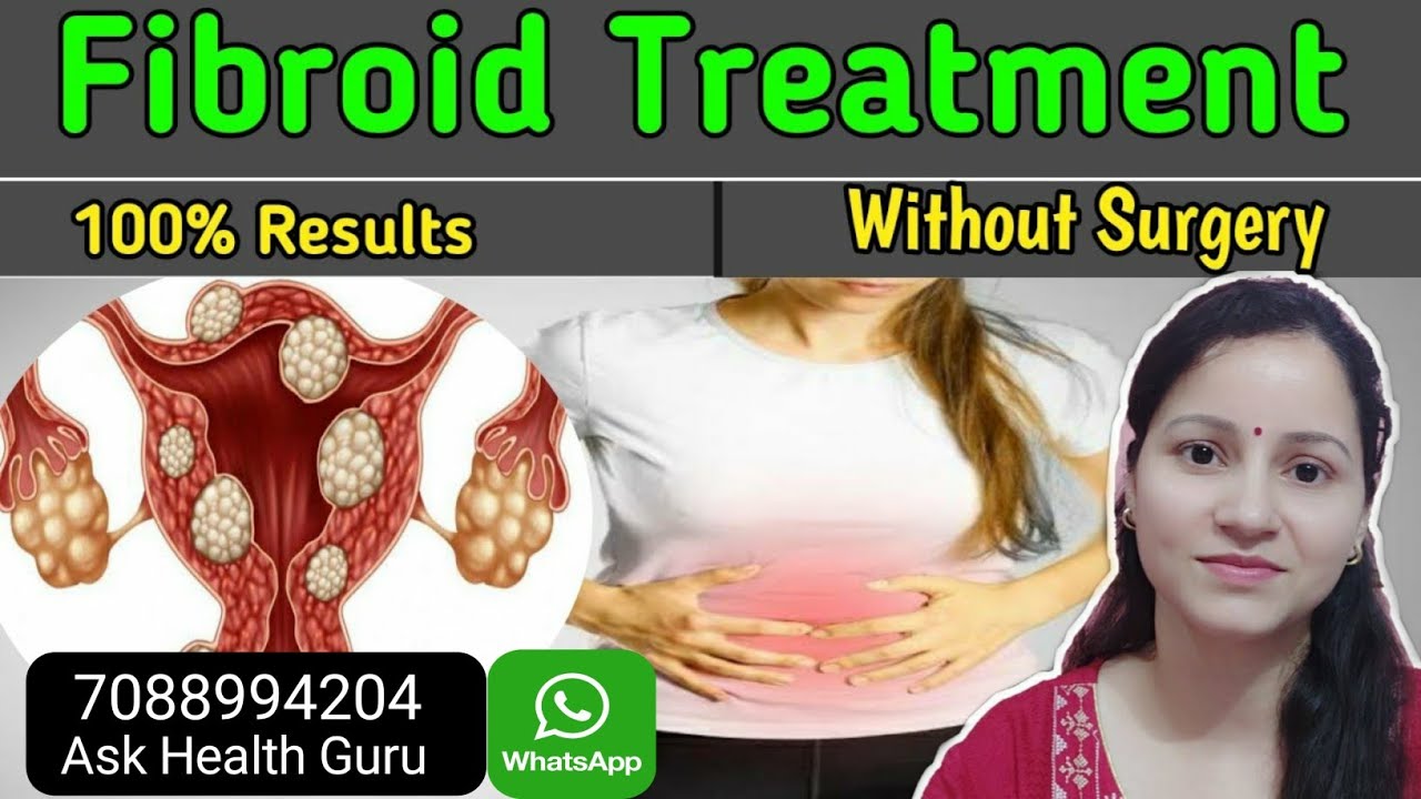 Uterine Fibroid Natural Treatment